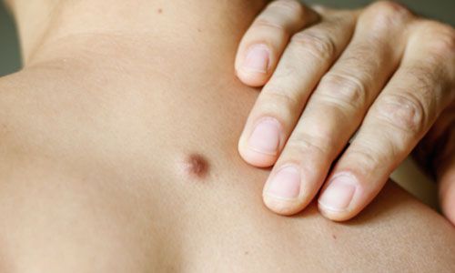 Lumps Vs. Bumps