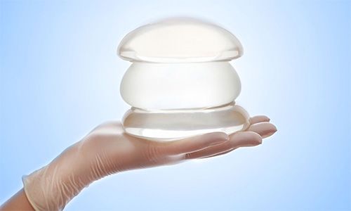 breast implant replacement