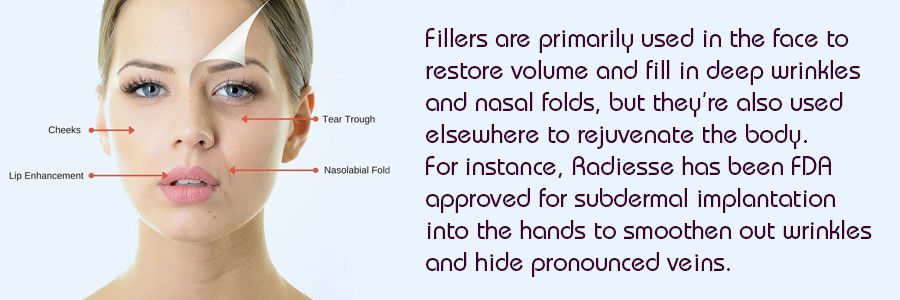 Dermal Fillers